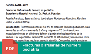 fractura-diafisarias-humero